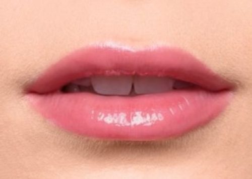 Lip_before